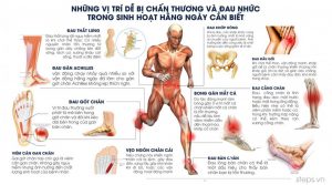 Những vị trí dễ bị tổn thương